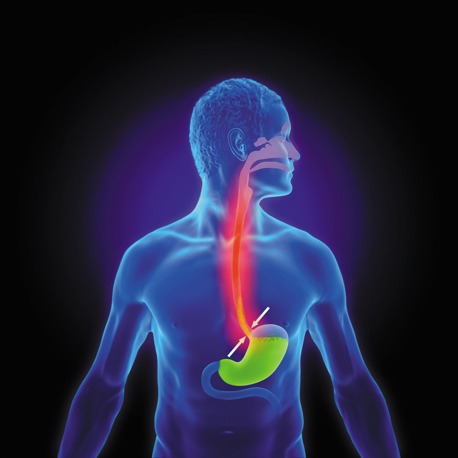 Top Medications for Treating Acid Reflux: A Comprehensive Guide by MCF Pharmacy